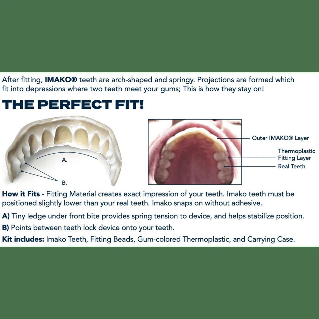 imako-premium-cosmetic-teeth-1-pack-small-bleached-white-upper-veneers-custom-fit-at-home-diy-smile-makeover-made-in-usa-05-f9e09754f5adc85403bbccf19b3fbd20.jpg