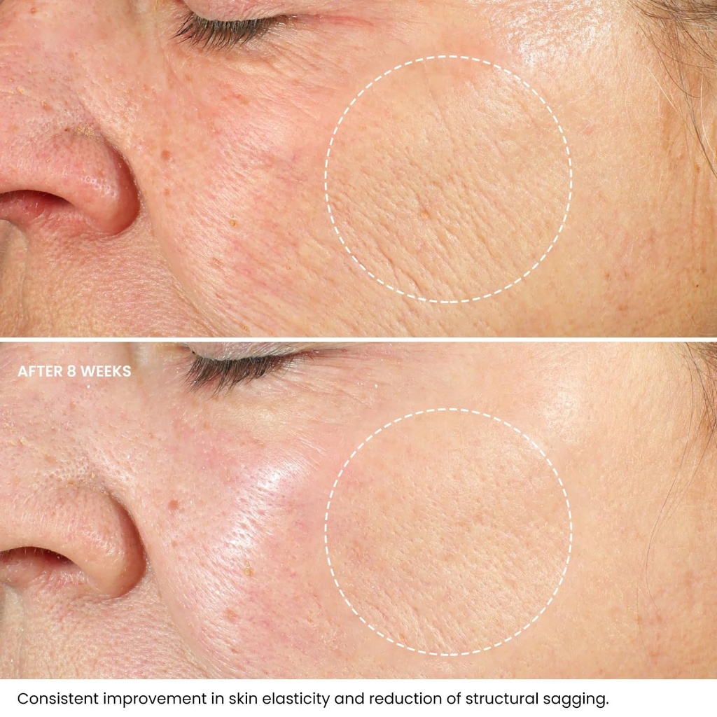 kleem-organics-retinol-moisturizer-2-5-retinol-and-hyaluronic-acid-for-face-r-02-12dbd66a9c3941c5eb908458a55f545f.jpg