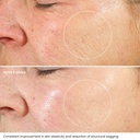 kleem-organics-retinol-moisturizer-2-5-retinol-and-hyaluronic-acid-for-face-r-02-12dbd66a9c3941c5eb908458a55f545f.jpg