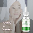 tinniease-skin-dropper-tinniease-spot-corrector-ear-soothing-agent-30-ml-04-13d61c18159d7003246ae81e80c80cae.jpg