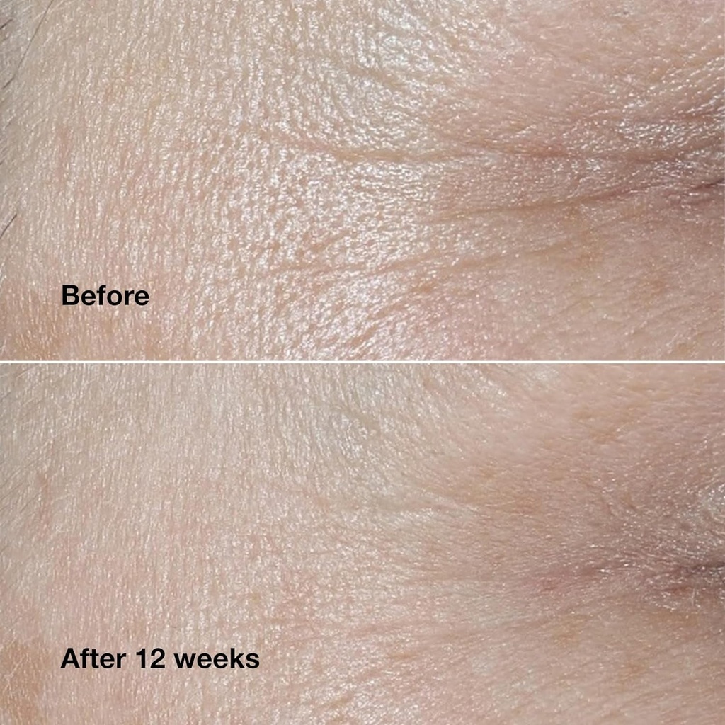 clinique-smart-clinical-repair-wrinkle-correcting-face-cream-04-f014ebc60468661b911bc7a672952e46.jpg