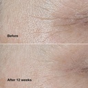 clinique-smart-clinical-repair-wrinkle-correcting-face-cream-04-f014ebc60468661b911bc7a672952e46.jpg