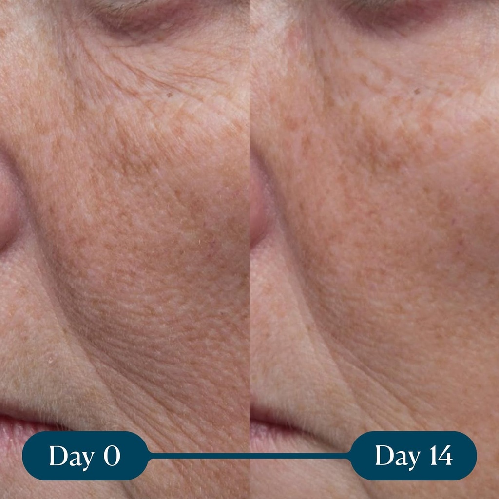 elemis-pro-collagen-marine-cream-lightweight-anti-wrinkle-daily-face-moisturizer-3-05-bbb19dcf980a7d75c8f6a15ed256f2cf.jpg