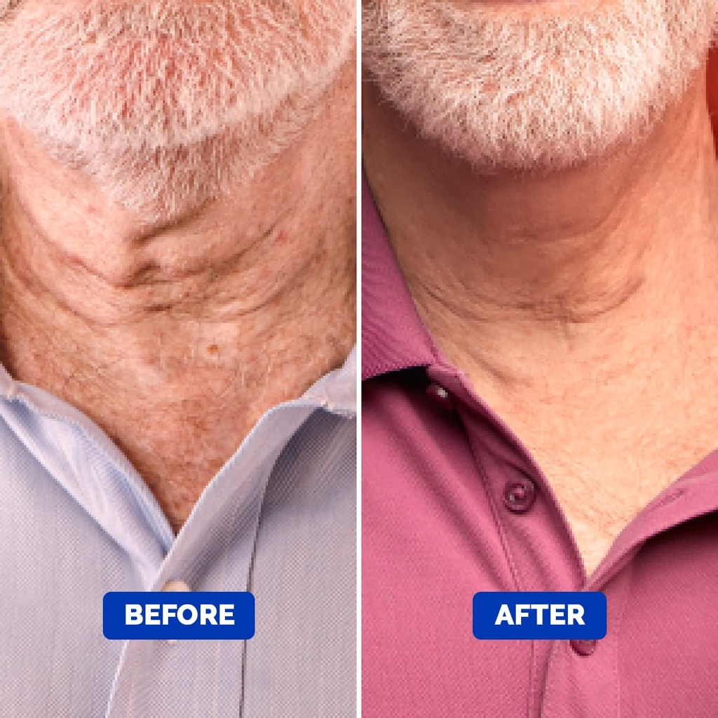 particle-neck-cream-for-men-firming-lift-and-moisturize-the-neck-use-on-sag-06-8abfaeced747f7ff8cc4f584921ccd4d.jpg