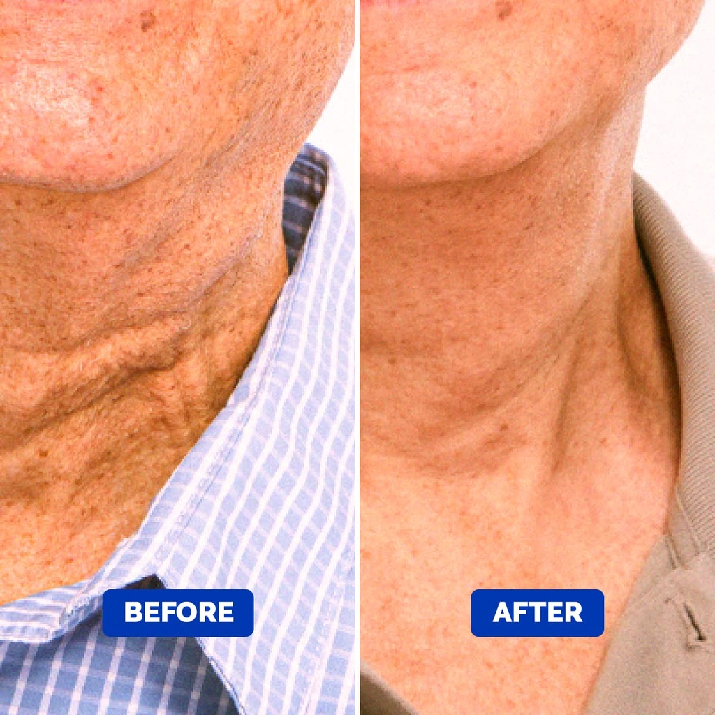 particle-neck-cream-for-men-firming-lift-and-moisturize-the-neck-use-on-sag-07-77174c013137d65ef96d75e10effc67d.jpg