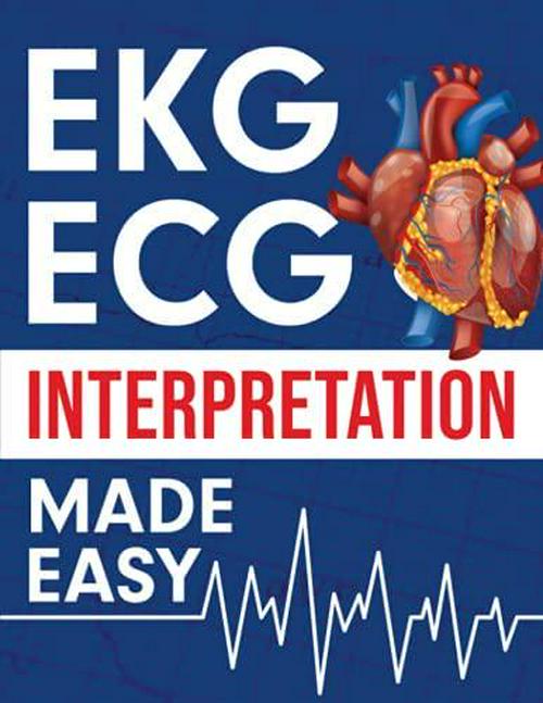 EKG | ECG Interpretation Made Easy: An Illustrated Study Guide For Students To Easily Learn How To Read and Interpret ECG Strips